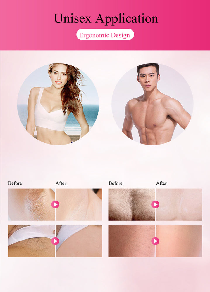IGIA Professional IPL Hair Removal Device