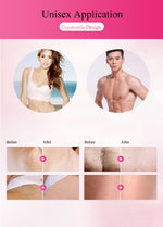 IGIA Professional IPL Hair Removal Device