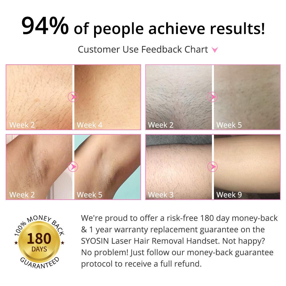 Professional IPL Hair Removal Device