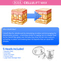 Cellulift Max Cellulite Reducing Suction Vacuum Massager