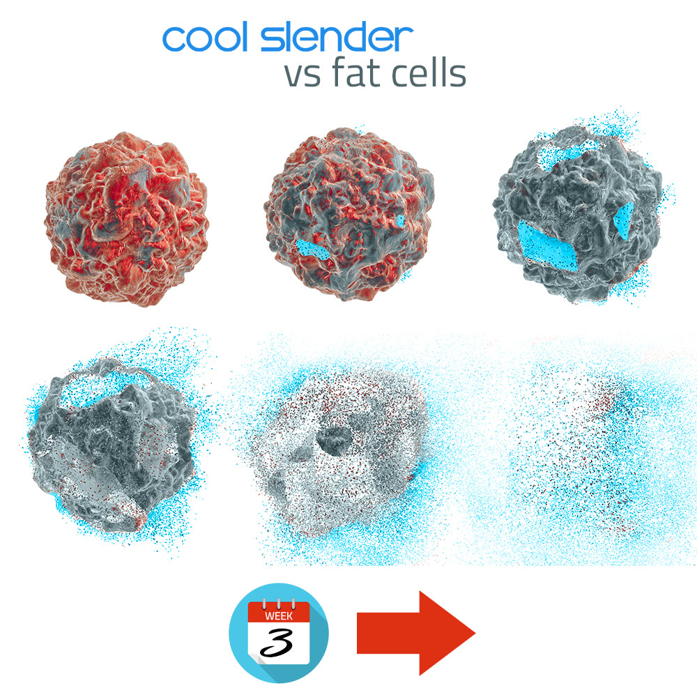 Cool Slender Fat freezing Kit