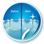 IGIA Pressure Water Flosser