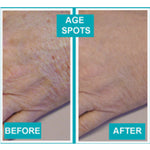 Diamond Secret Microdermabrasion System
